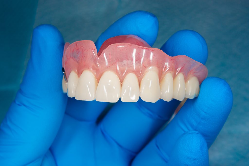 Dental Implants vs. Dentures