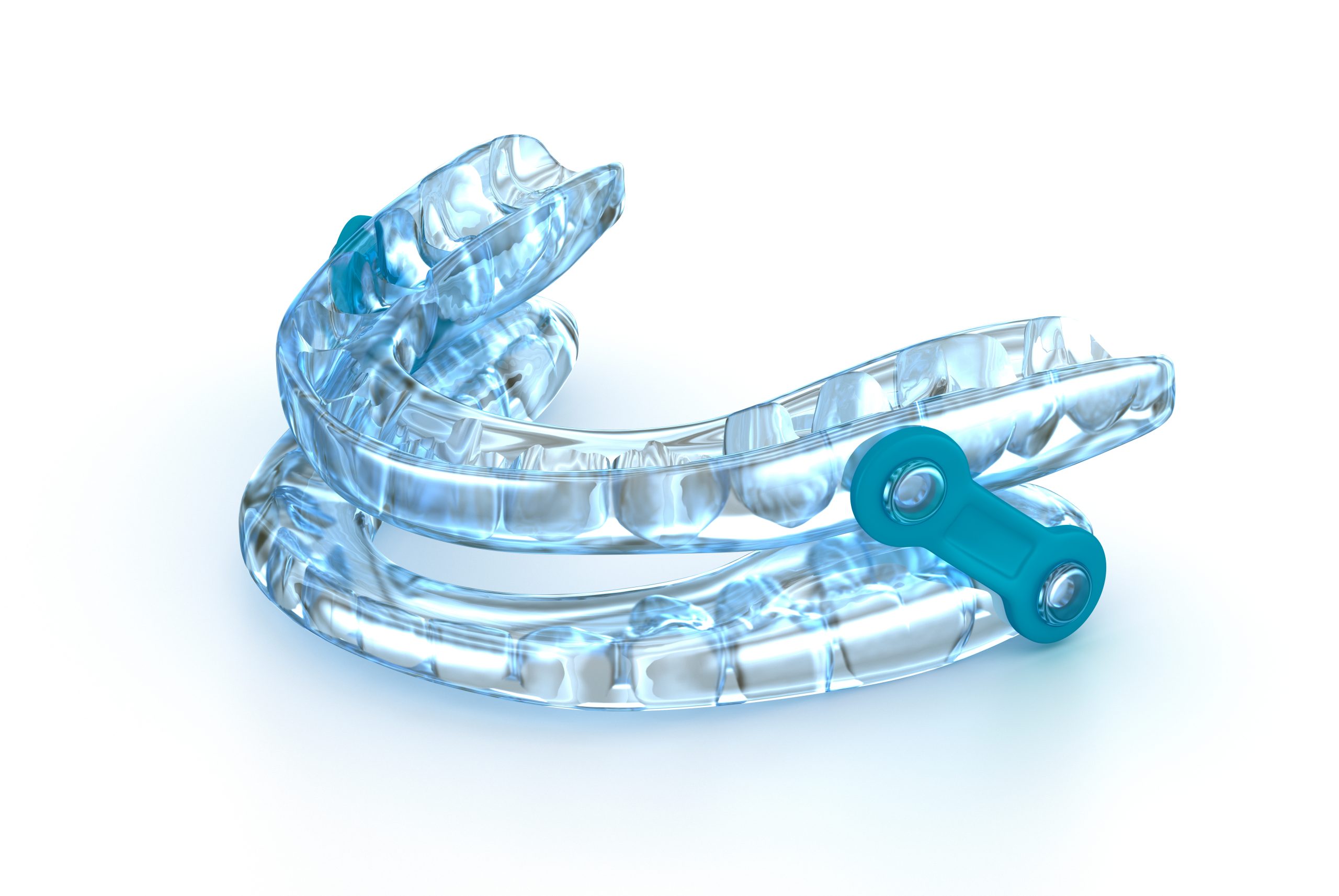 Custom oral appliance therapy